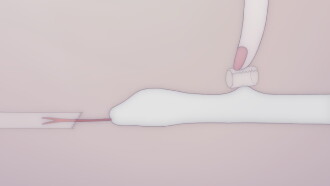 Anxious Body Trailer
