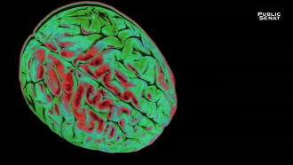 Le pouvoir nuit-il gravement au cerveau ? Trailer
