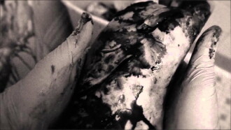 Lung Trailer