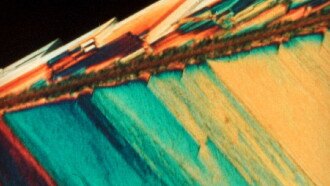 Pigment-Dispersion Syndrome Trailer
