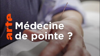 Spitzenmedizin: Akupunktur - Mythos oder Therapie? Trailer
