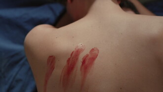 Wound Trailer