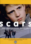 Scars