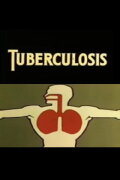 Health for the Americas: Tuberculosis
