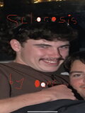 Sclerosis