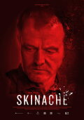Skinache