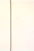 MA (Intervals)