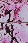 Lovesong 3