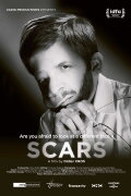 Scars
