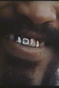 Estética