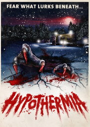 Hypothermia Hypothermia