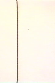 MA (Intervals) MA (Intervals)