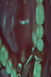 Macrozoom