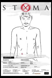Stoma