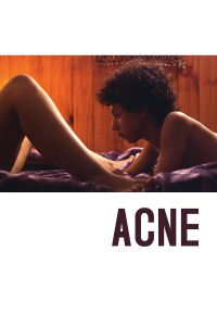 Acne (2008)