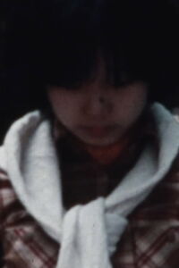 Bizarre disease Ⅰ (1977)