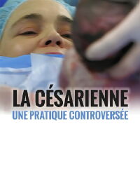 La césarienne - une pratique controversée (2016)