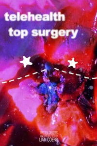telehealth top surgery (2024)