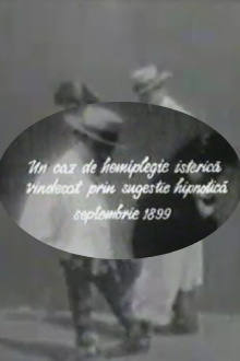 A Case of Hysterical Hemiplegia Cured Through Hypnotic Suggestion Trailer
