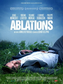 Ablations Trailer
