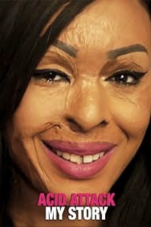 Acid Attack: My Story Trailer