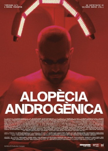 Androgenic Alopecia Trailer