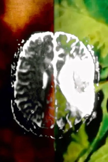 Aphasia or (It Fell Upon My Mind) Trailer