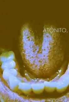 Atônito, Eu. Trailer