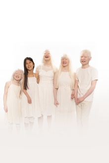 Born with Albinism Trailer