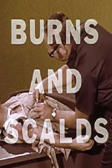 Burns And Scalds Trailer