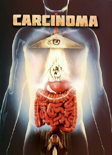 Carcinoma Trailer