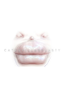 Caterpillarplasty Trailer