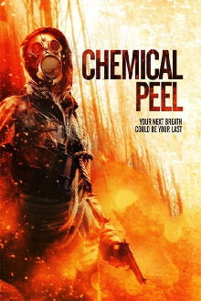 Chemical Peel Trailer