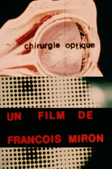 chirurgie optique Trailer