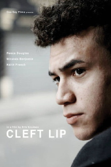Cleft Lip Trailer