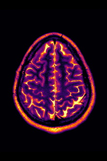 Conclusion: Stable Disease Trailer
