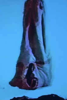 Crisalide Trailer
