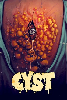 Cyst Trailer