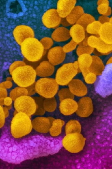 Did Covid Leak from a Lab in China? Trailer