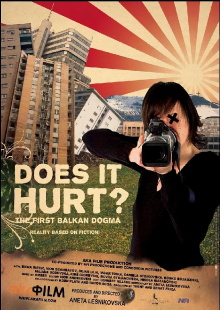 Does it Hurt? Trailer
