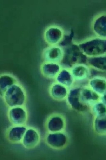 ERYTHROPOIEISIS AND ERYTHROPOIETIN Trailer