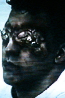 Esophagus Trailer
