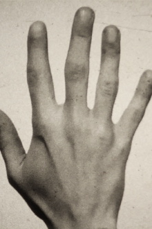 Fifth Metacarpal Trailer