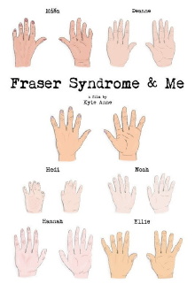 Fraser Syndrome & Me Trailer