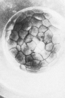 Gestation of the Ovum Trailer