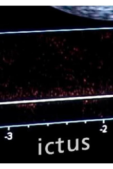 Ictus Trailer