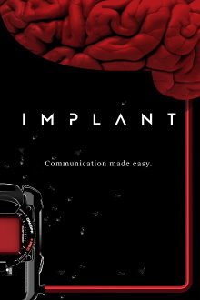Implant Trailer