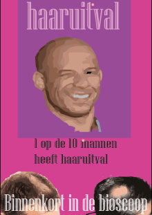 Kaal worden. Wat kan ik doen? Trailer