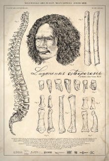 Luzonensis Osteoporosis Trailer
