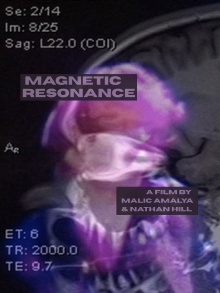 Magnetic Resonance Trailer